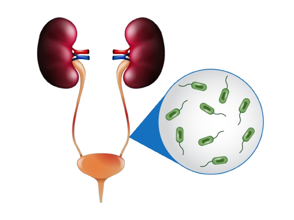 Chronic Kidney Disease