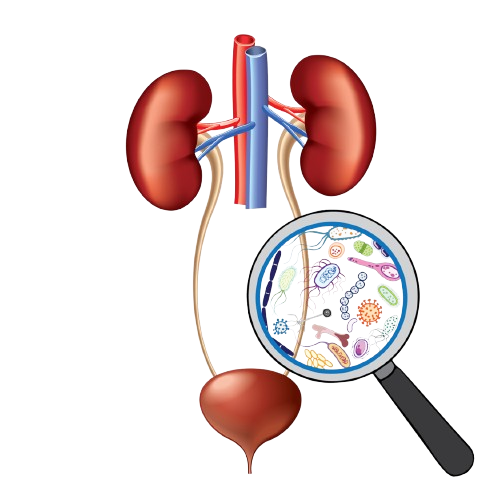 Chronic Kidney Disease