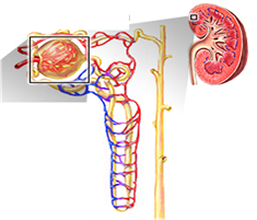 Glomerulonephritis