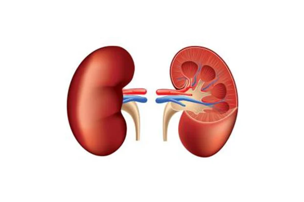 Kidney Transplant